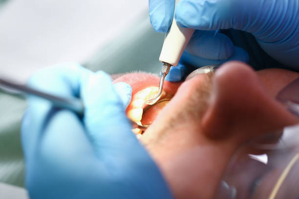Best Pediatric Emergency Dentist in West Peoria, IL